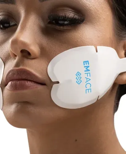 EMFACE treatment on the cheeks