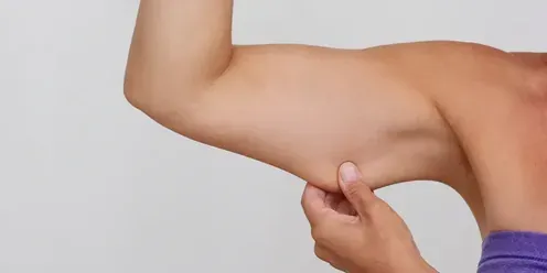 Skin laxity