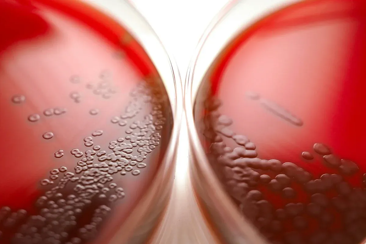 Lab technician analyzing blood work results — Ideal Medical clinic