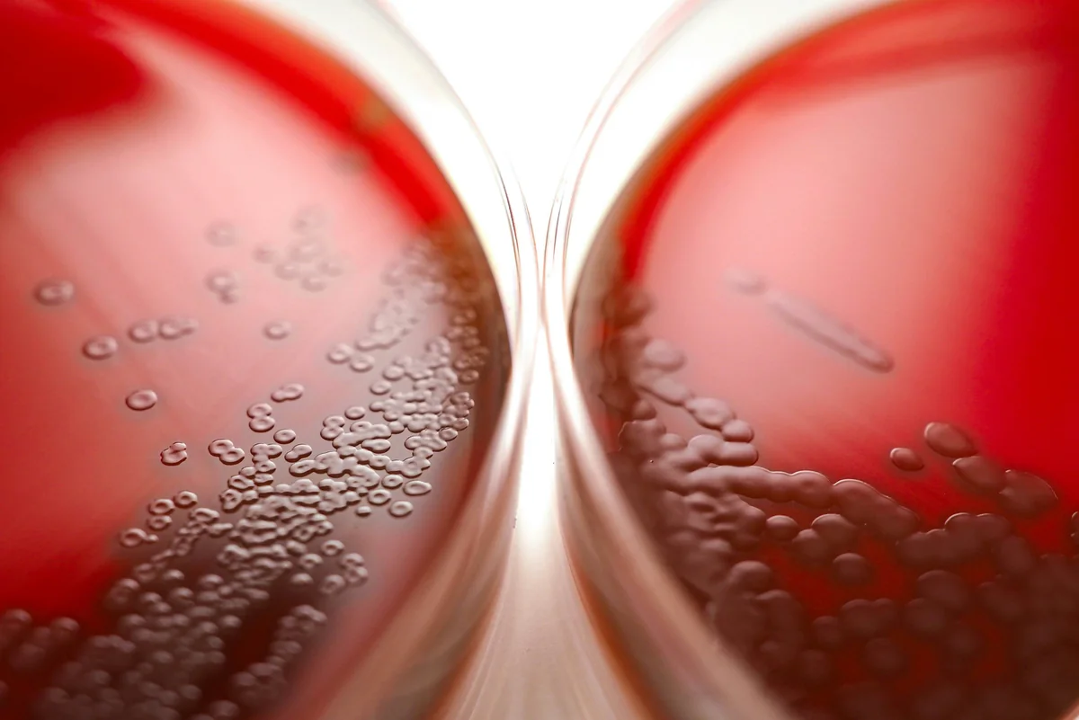 Lab technician analyzing blood work results — Ideal Medical clinic