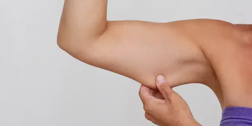 Skin laxity